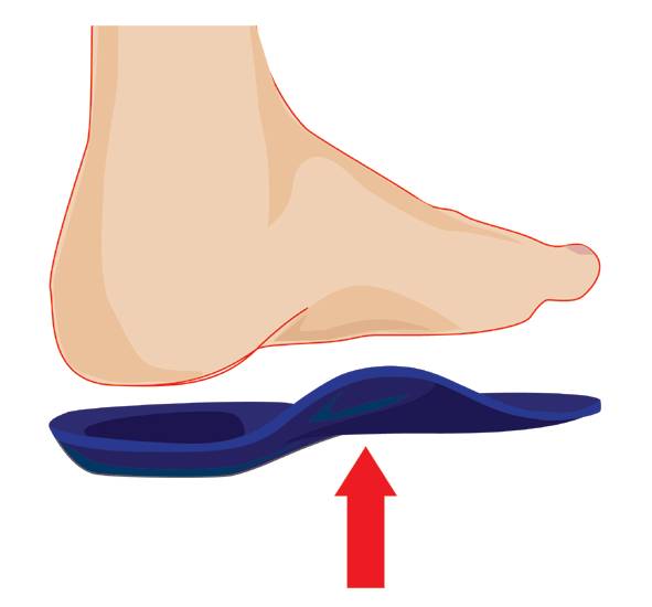 orthotics for feet